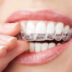 FGM Whiteness Perfect %16 Ev Tipi Beyazlatma Tekli Şırınga