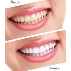 Ultradent Opalescence PF 16% Ev Tipi Beyazlatma 2'li Şırınga